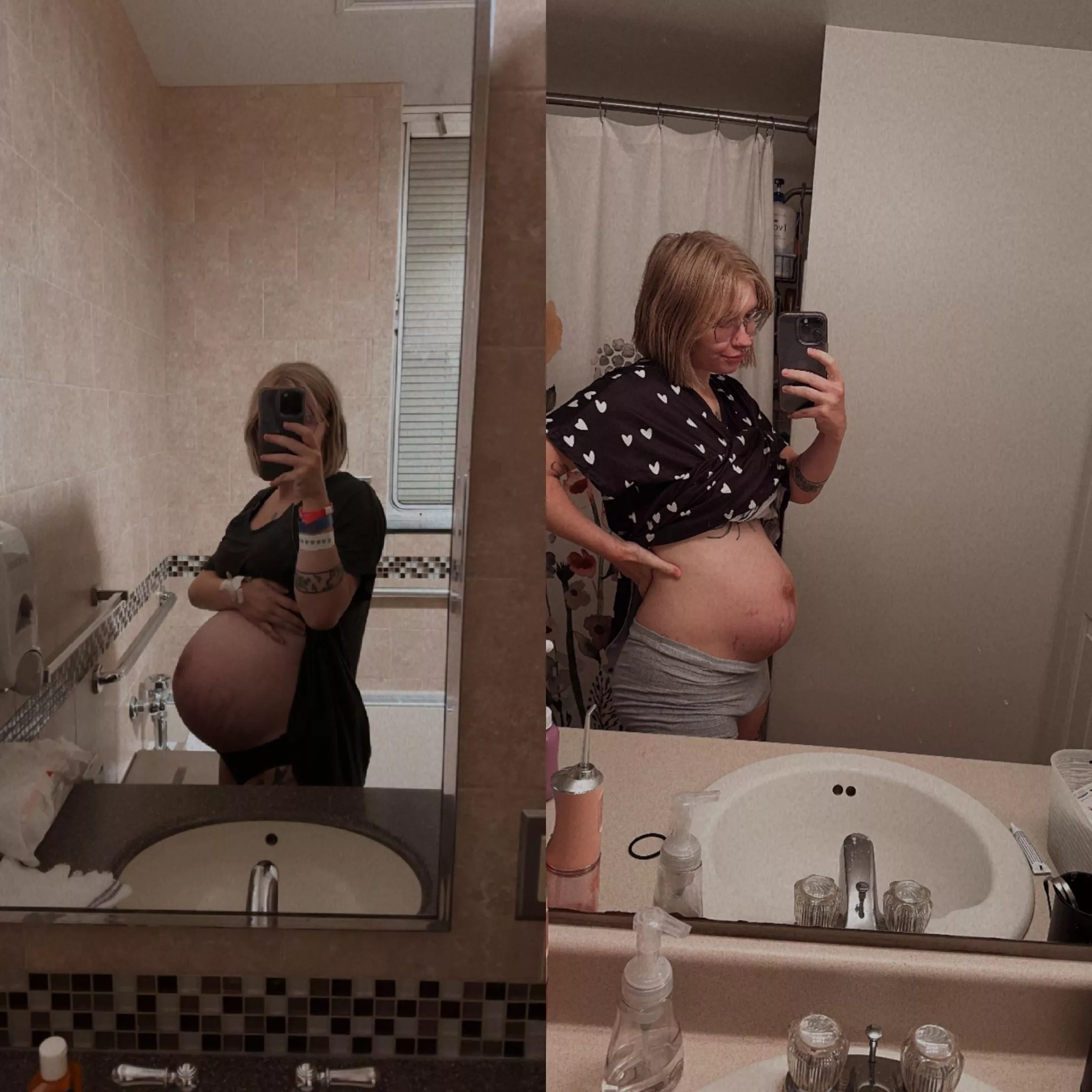 Last pregnancy pic vs postpartum  posted by Monique_dancing