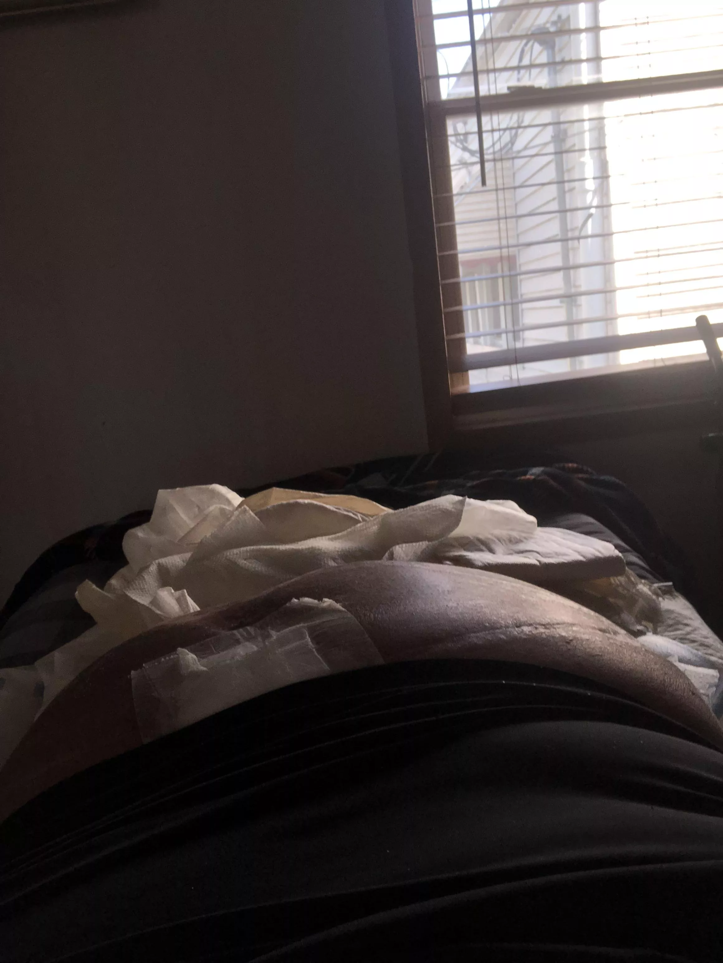 Gay superchub bottom in a wheelchair and paralyzed from the waist down with a big ass. Looking in the US.  Sorry for the bandage if you’re still interested hmu posted by Training-Dog7661