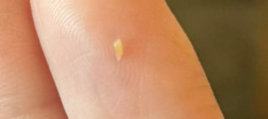 Little things that come out of my back  by Bri_le