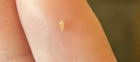 Little things that come out of my back  posted by Bri_le