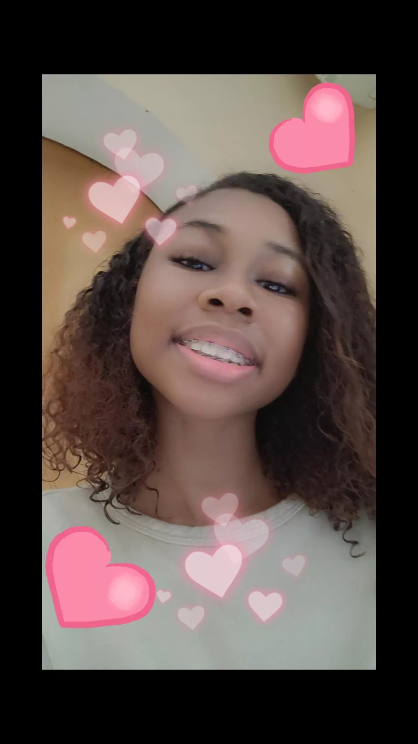 Brace face baby girll 🥰🥰🧁 posted by blueFloress