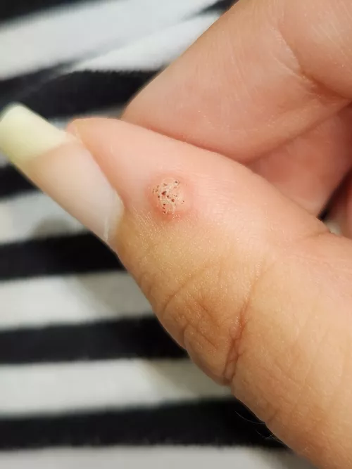 Feel like I should just take some nail clippers to this thing.  by InvisibleScorpion7