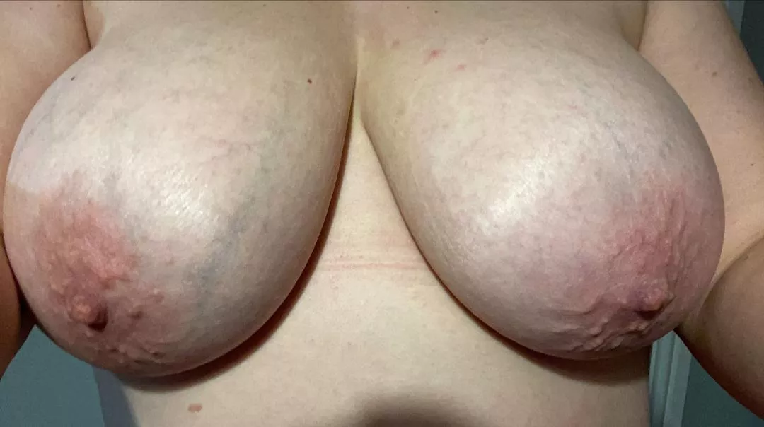 Glad to get them free tonight, feel like there going to explode 💣💣💥 posted by mulbomb