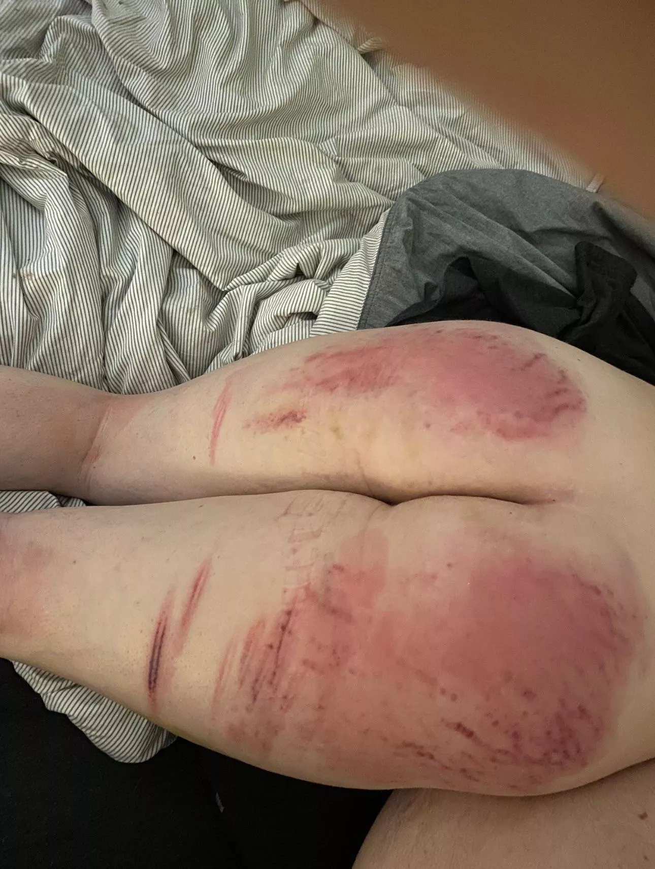 What all do you think was used during my punishment?  posted by DemiLovve