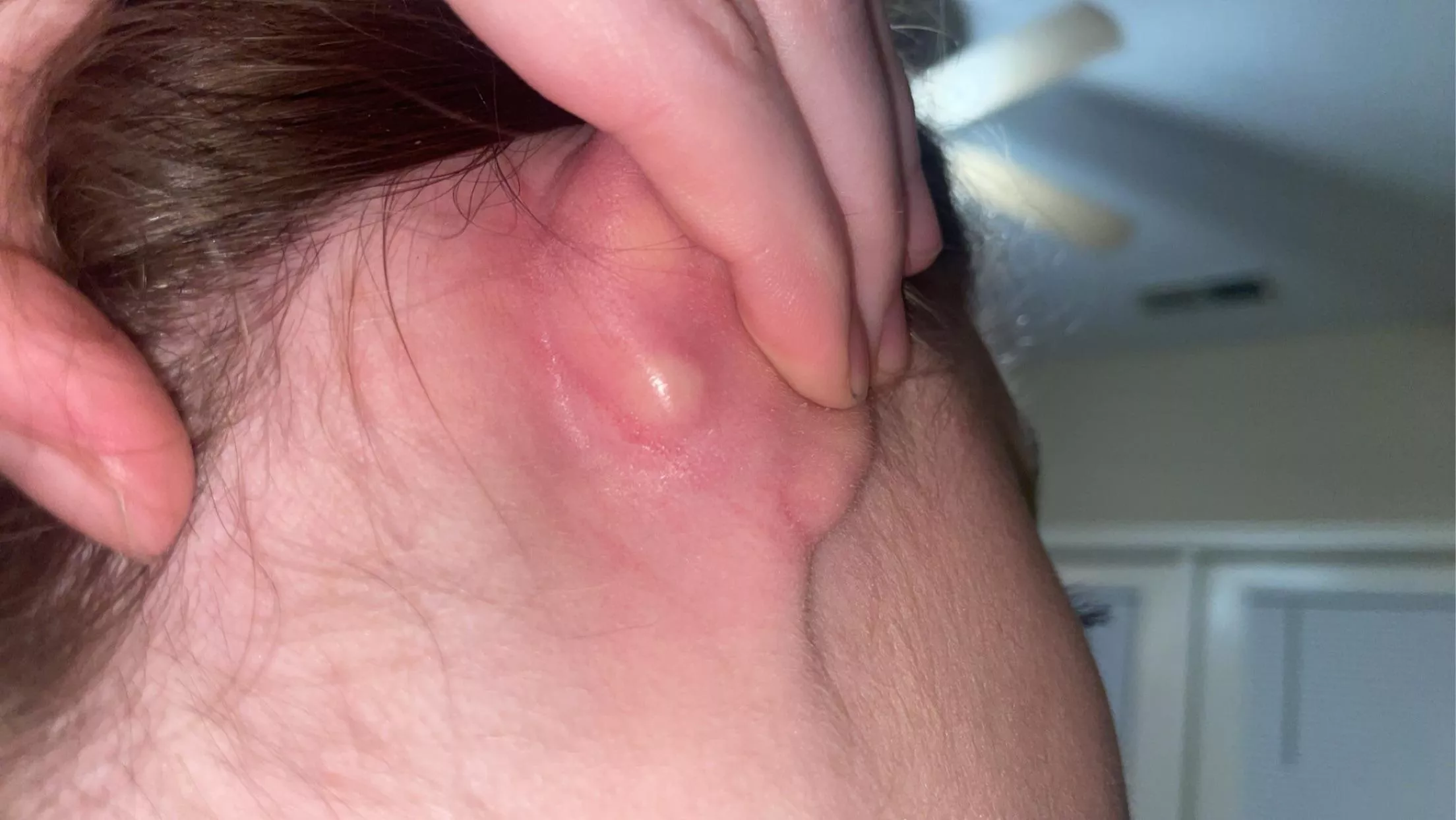 forbidden pop on the back of my ear posted by Less-Whole-2434