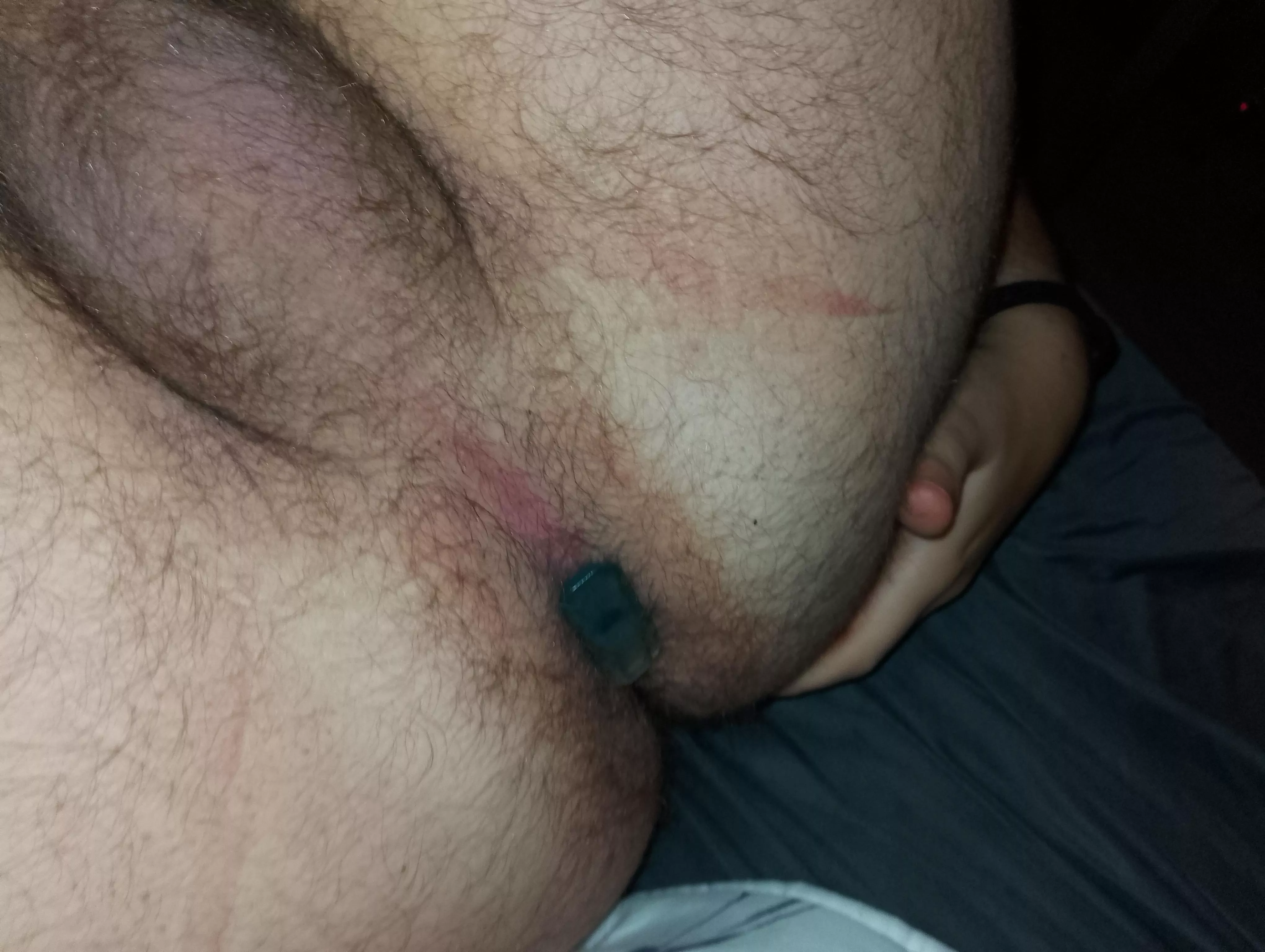 Age 24 next day with plug inside  posted by RedJanus2000