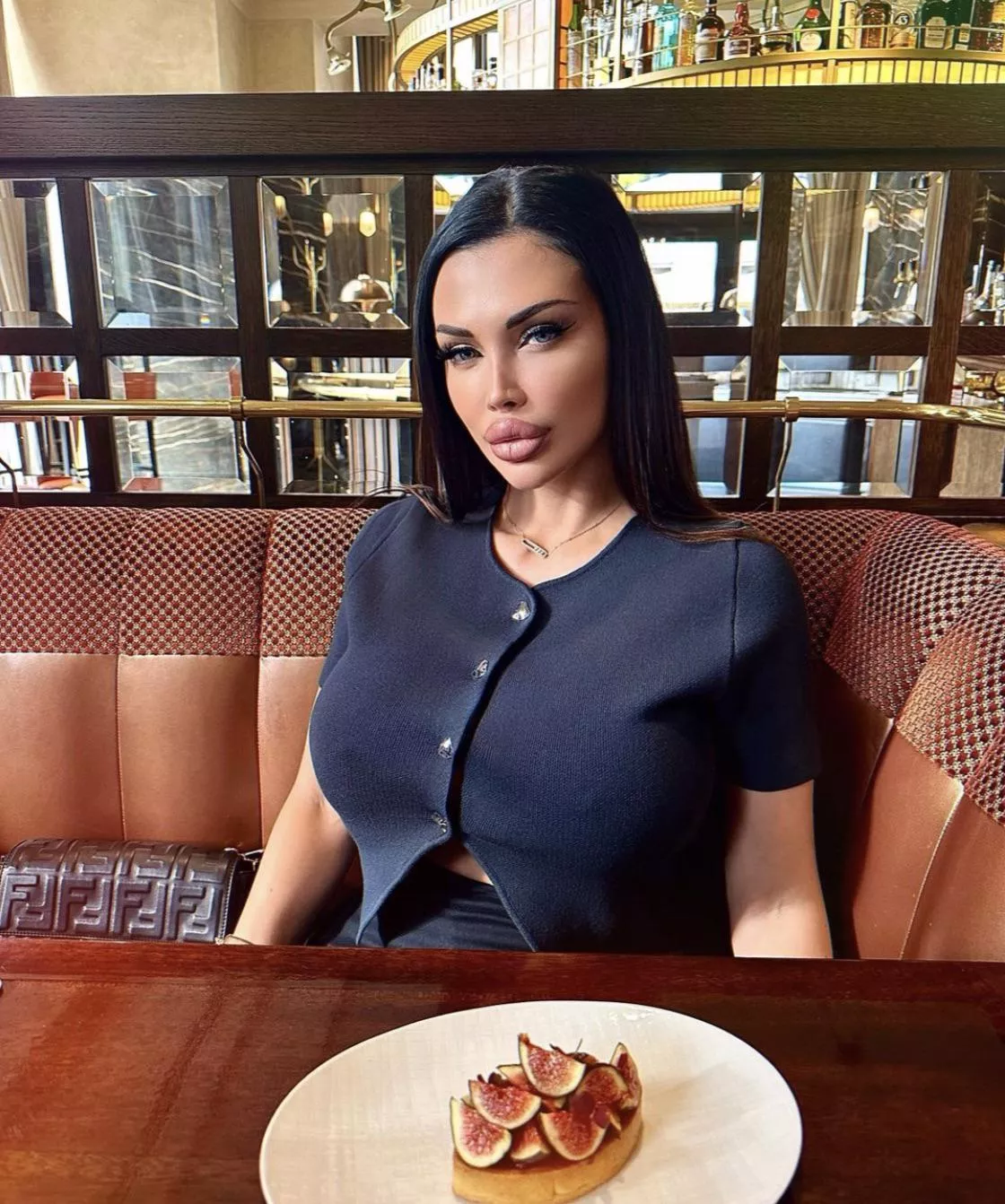 Aletta got even more perfect after her face lift. She should be considered as one of the of not THE hottest women ever! posted by melothw