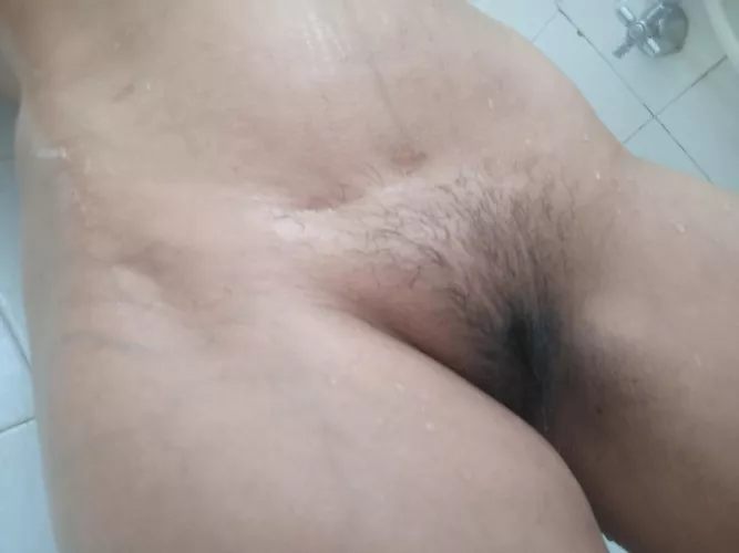 Caesarean scar by SugarSirenx