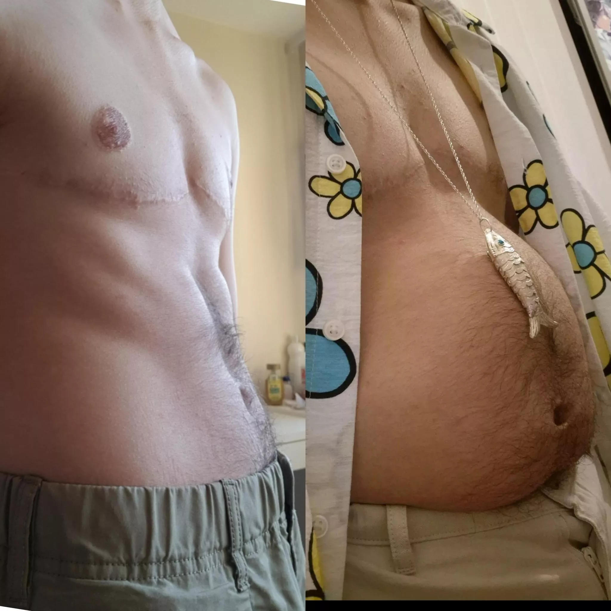 Really crazy what beers, cream and mayonnaise added in your daily meals can do to a body posted by Busy_Copy_912