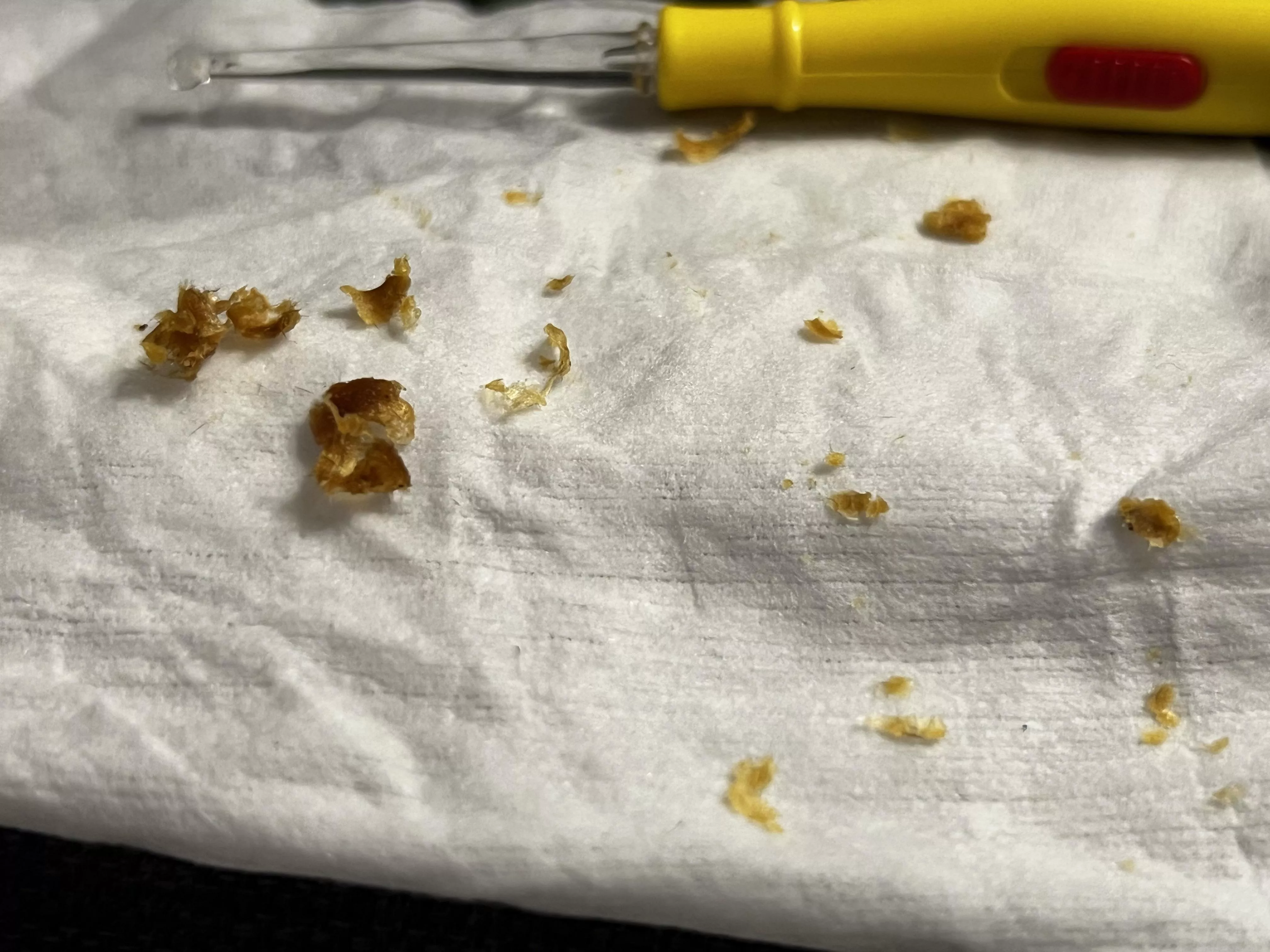 My son asked me to clean his ears posted by KremKaramela