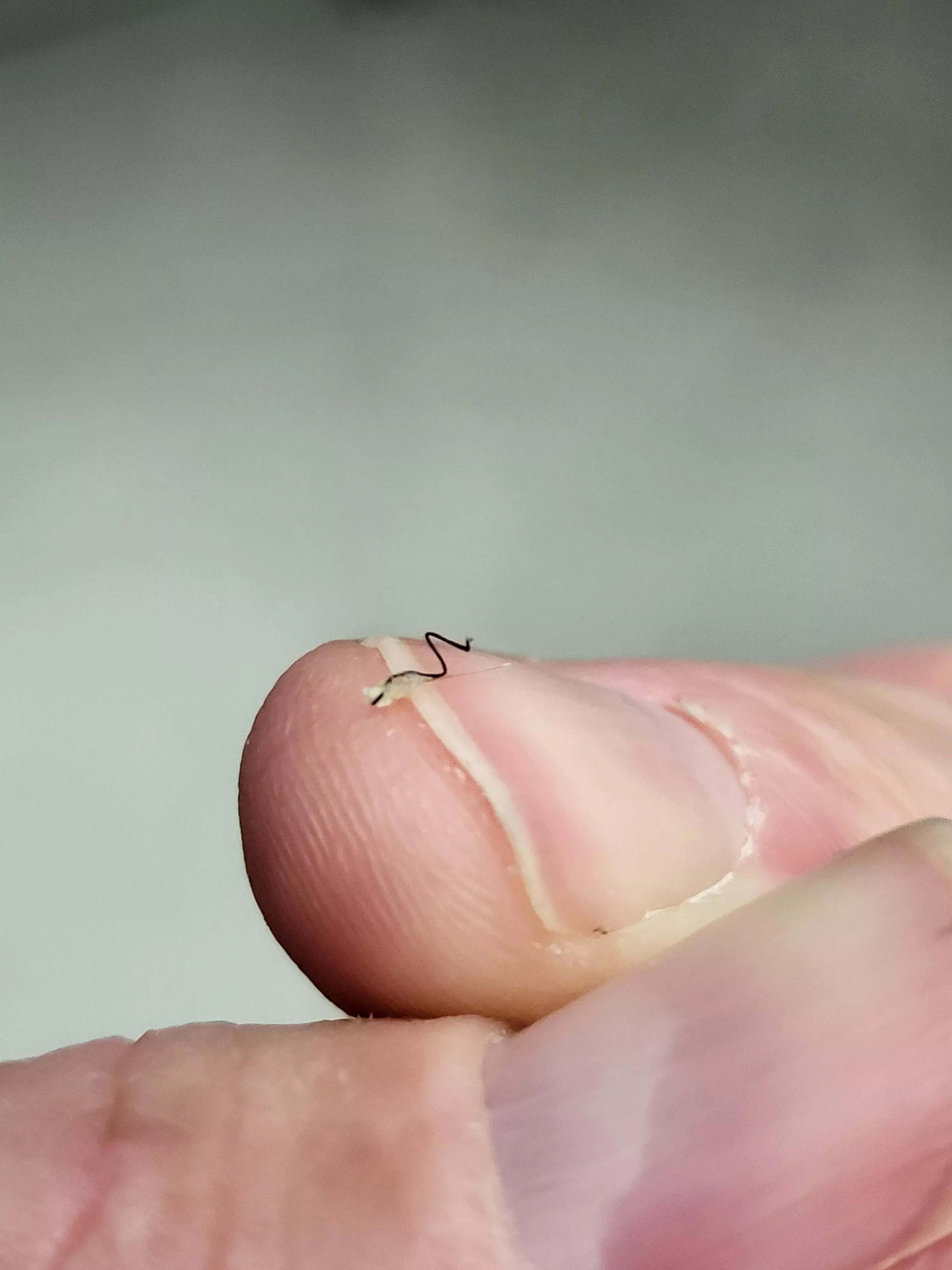Two hairs from the same follicle. posted by Caddacus