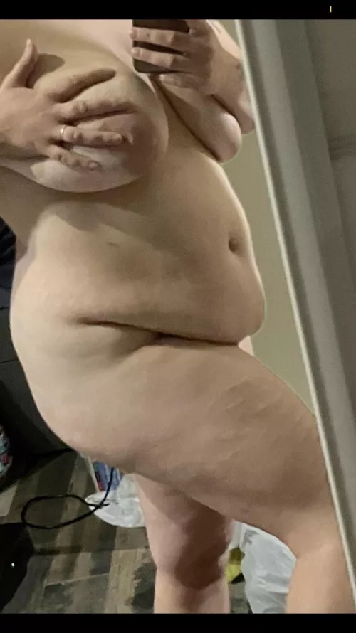 F30. Belly, scars and all. 5’4 180lb by Interesting-Fun1382