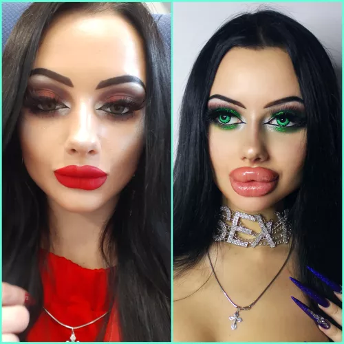 I’m 18 on the left, 3 cc . Right one is 21 and 24cc by Fine-Ad2329