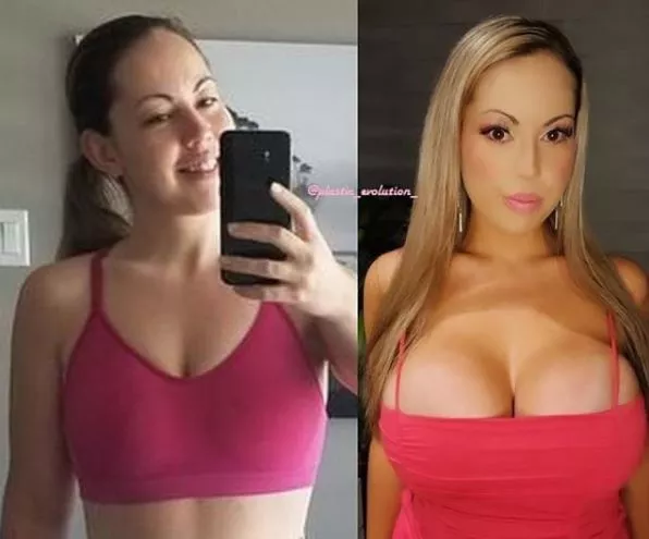 My transformation since june <3 posted by Possible-Ad-6813