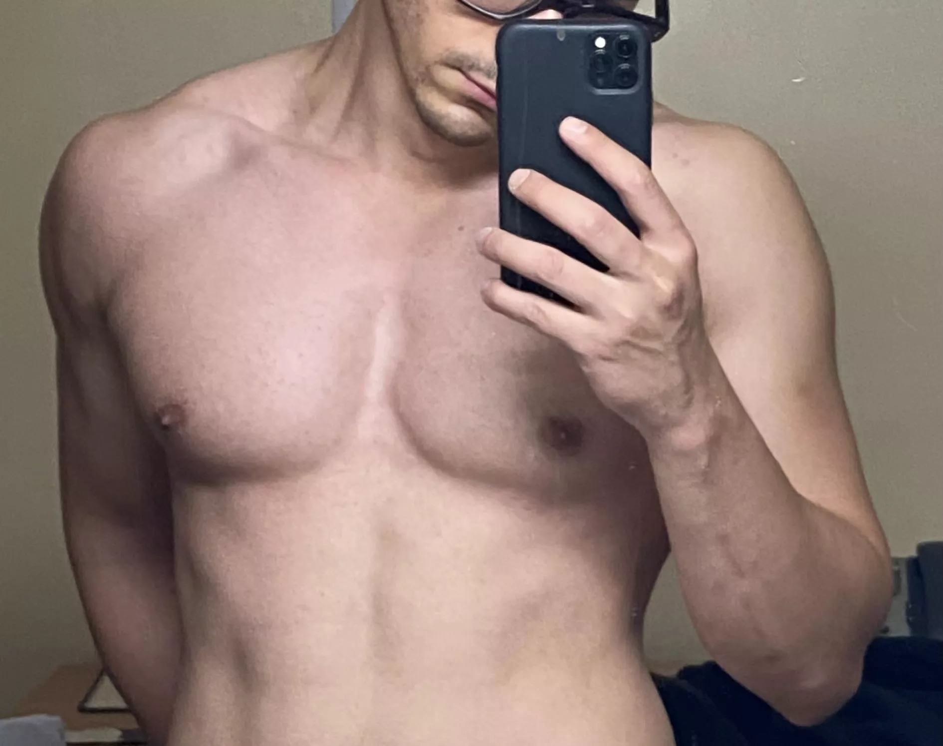 spot the climbing scar posted by Otherwise_Key1150