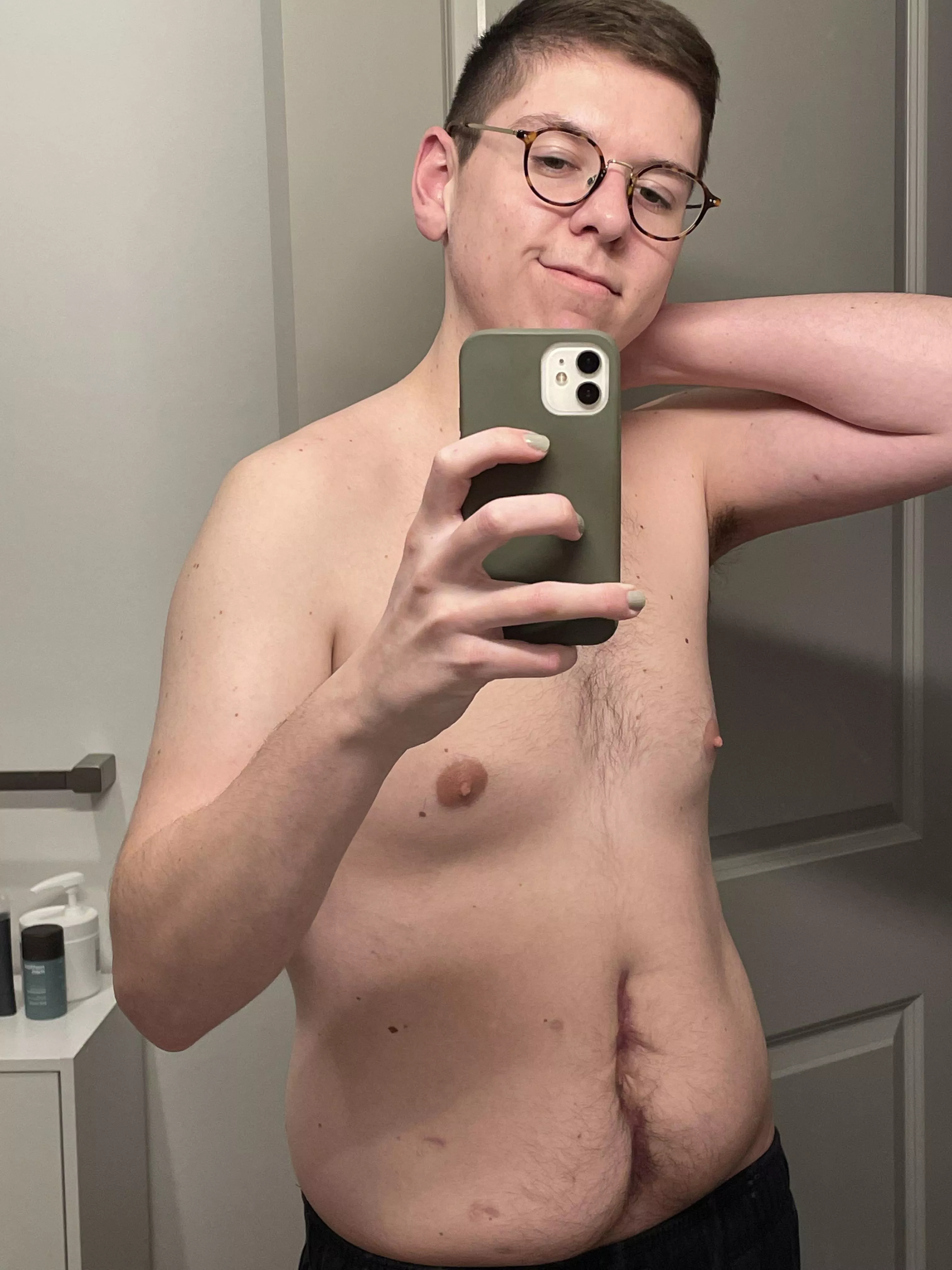 Three months ago, I had sepsis and almost didn’t make it. I now have this scar as a reminder of what I am capable of overcoming. I’m learning to love myself, scar and all. Bodies aren’t perfect, don’t obsess over obtaining perfection. Nightly ram posted by Electrical-Shallot-2