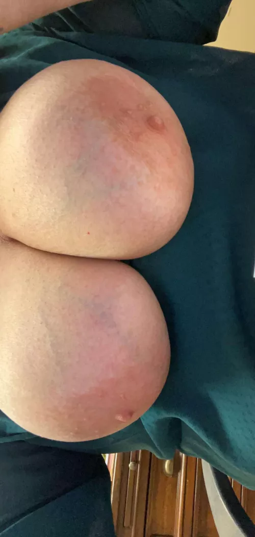 Big tits anyone? by pthole