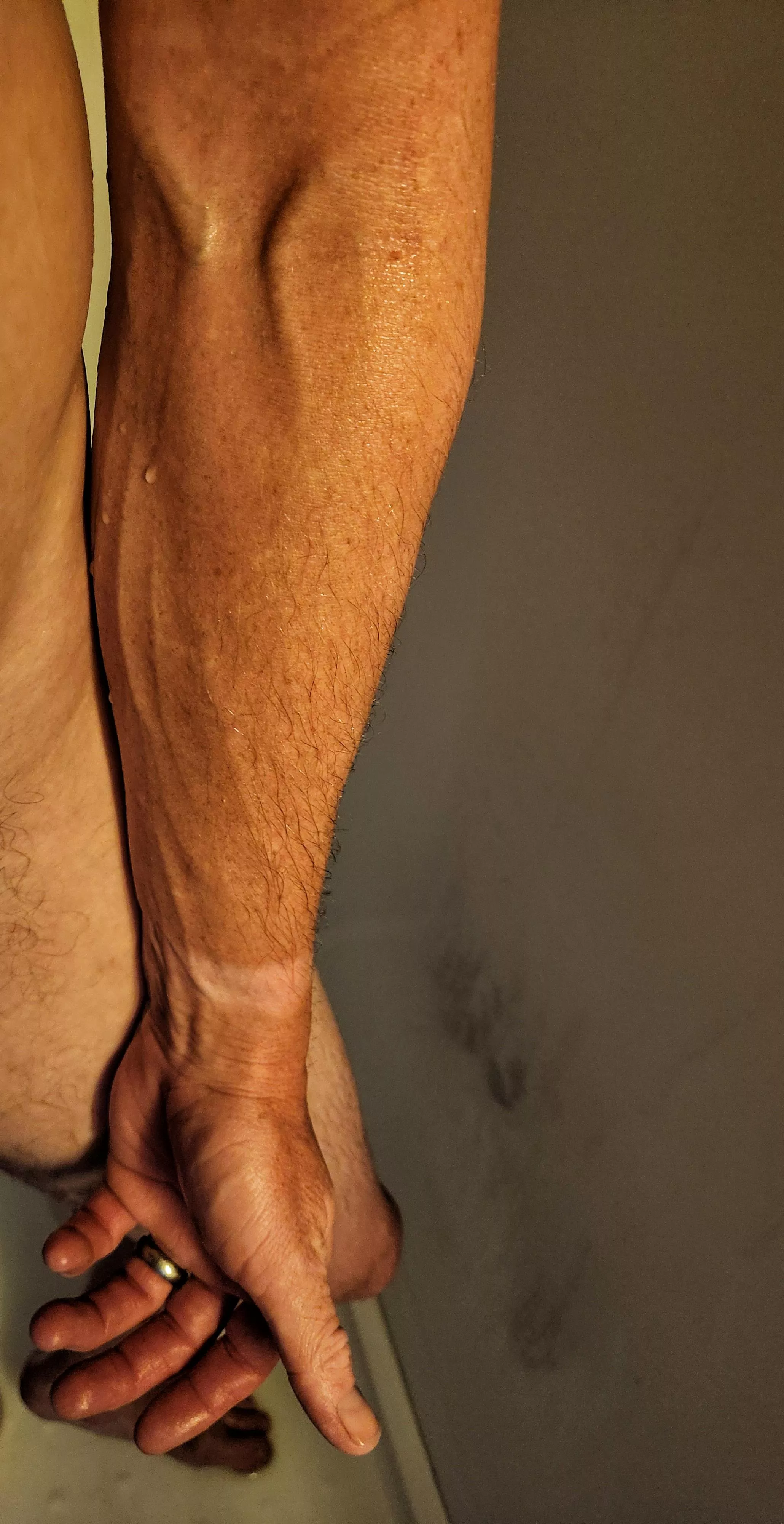 Post for attention, or was it all in vein? posted by Sch5ive