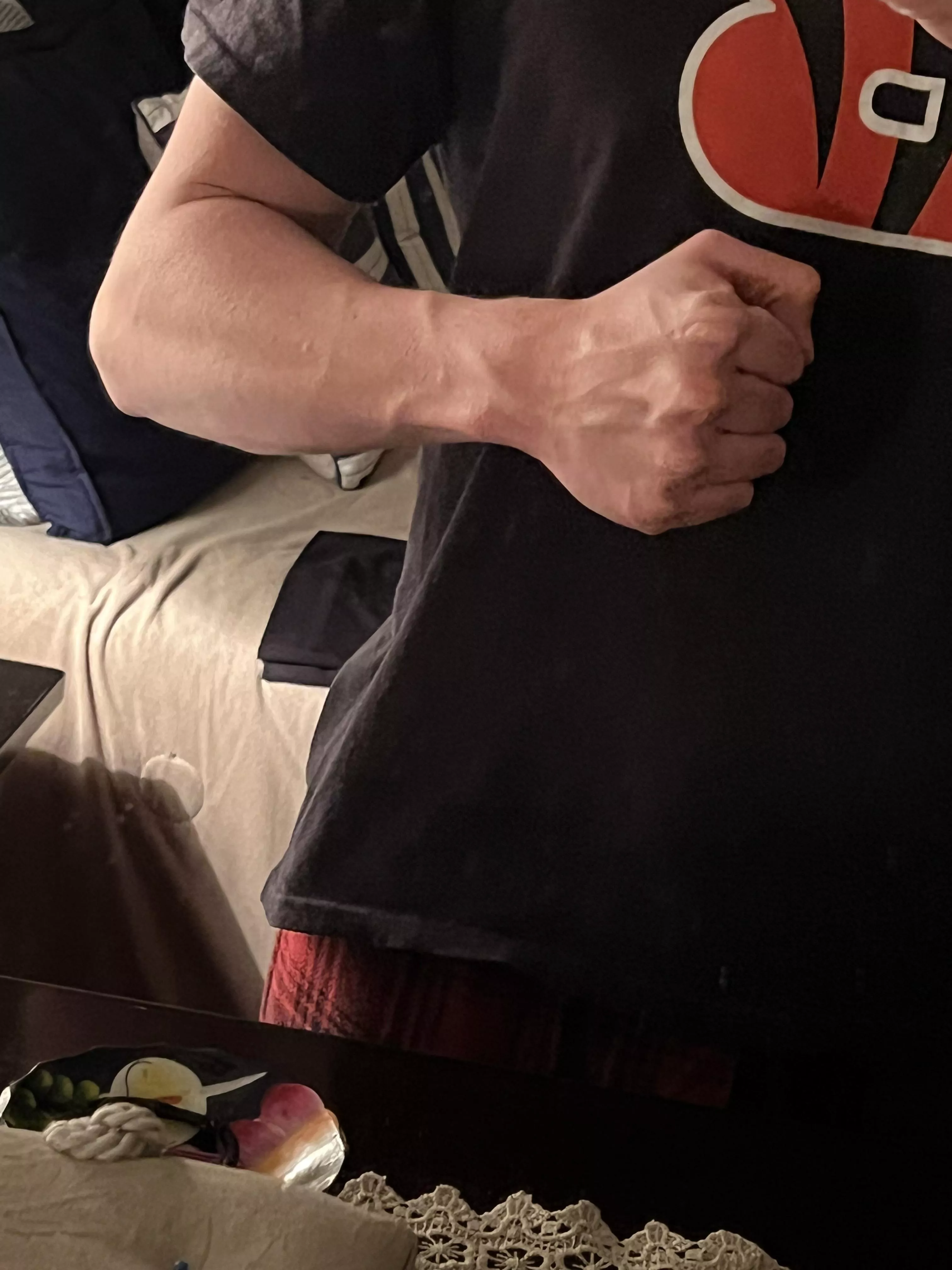Does my forearm qualify for this sub? posted by FanboyPhx09