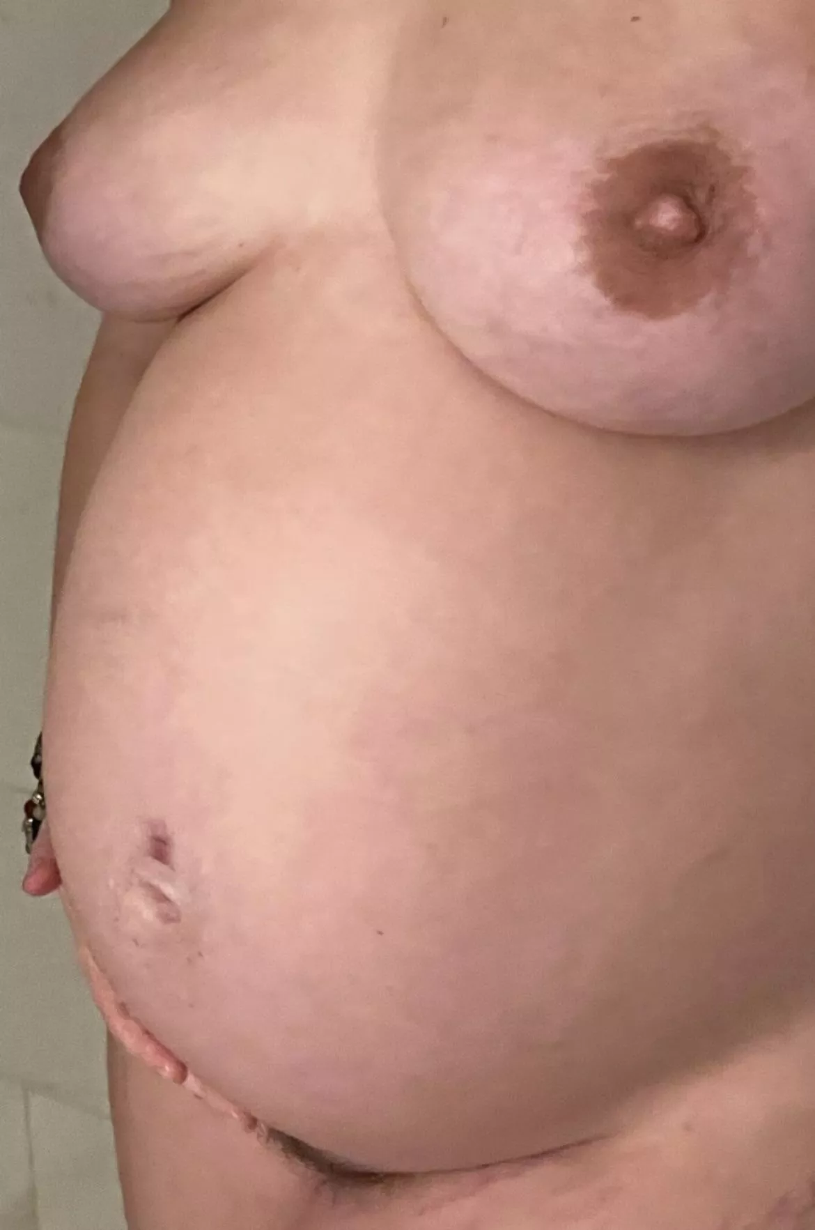 How’s my bump looking? posted by noodzthrowawayz