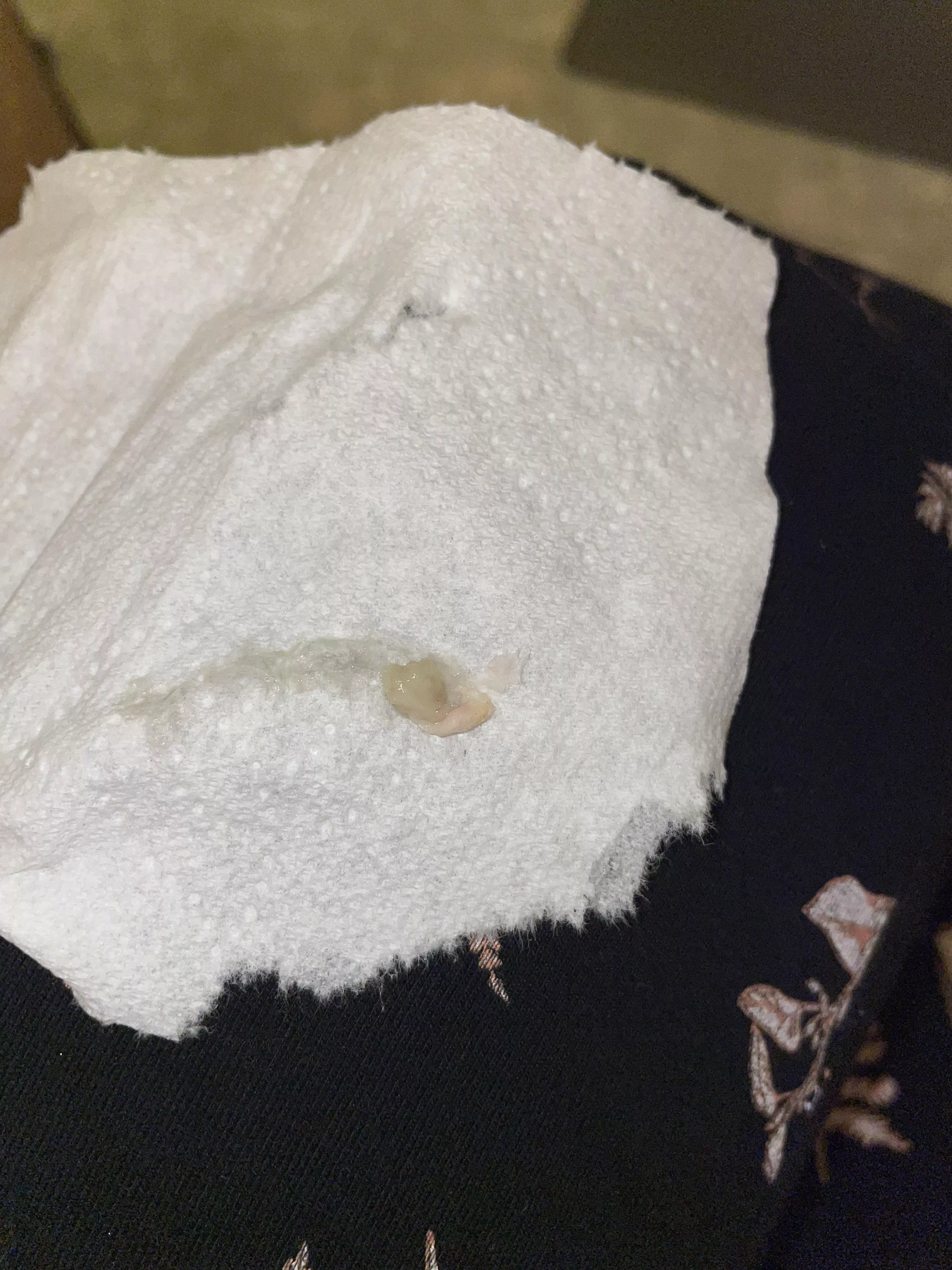 I finally got the core out of my abscess!!! posted by Fearless_Finish9185