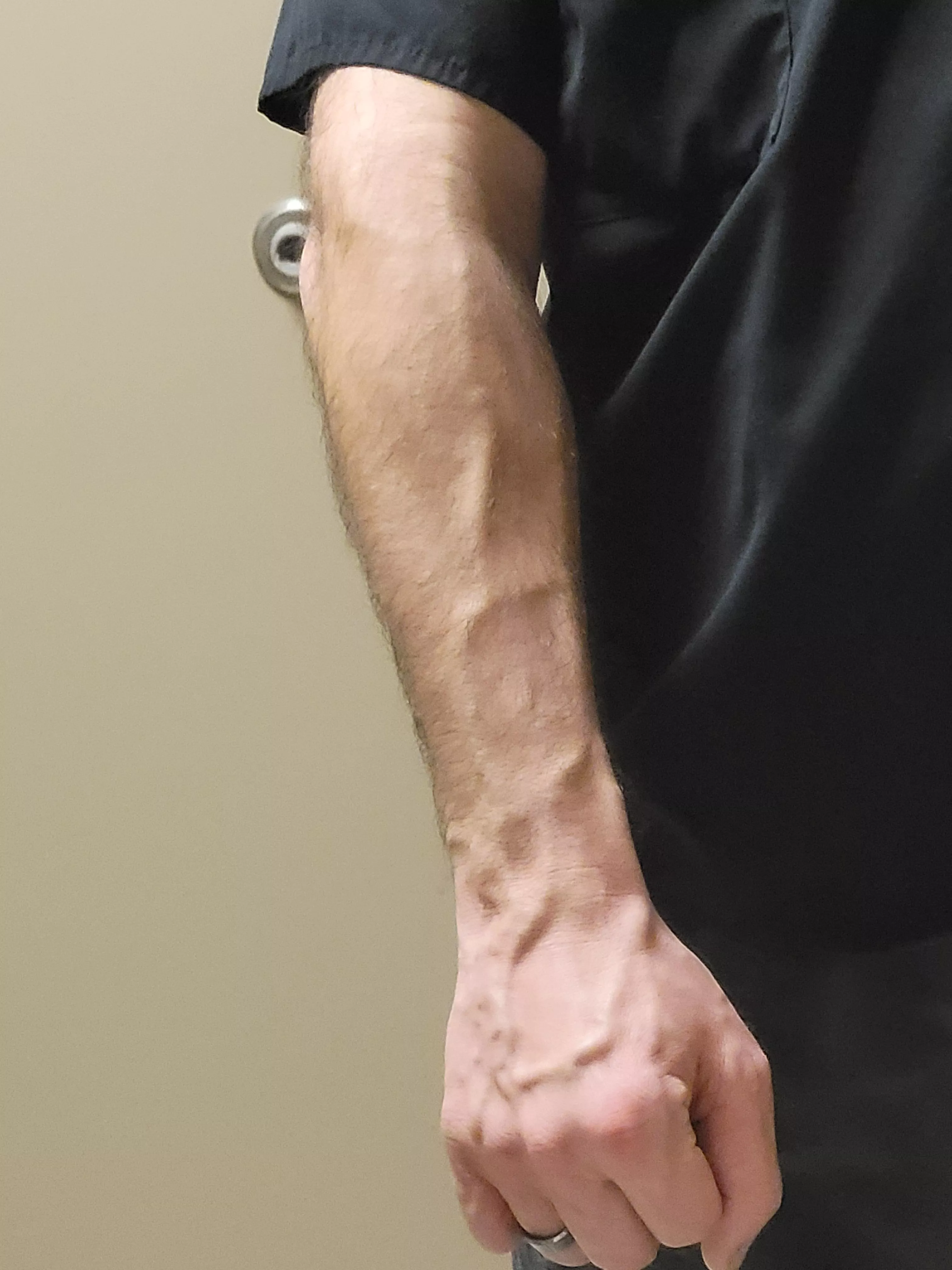 no big muscles here but veins are poppin today posted by ROC3423