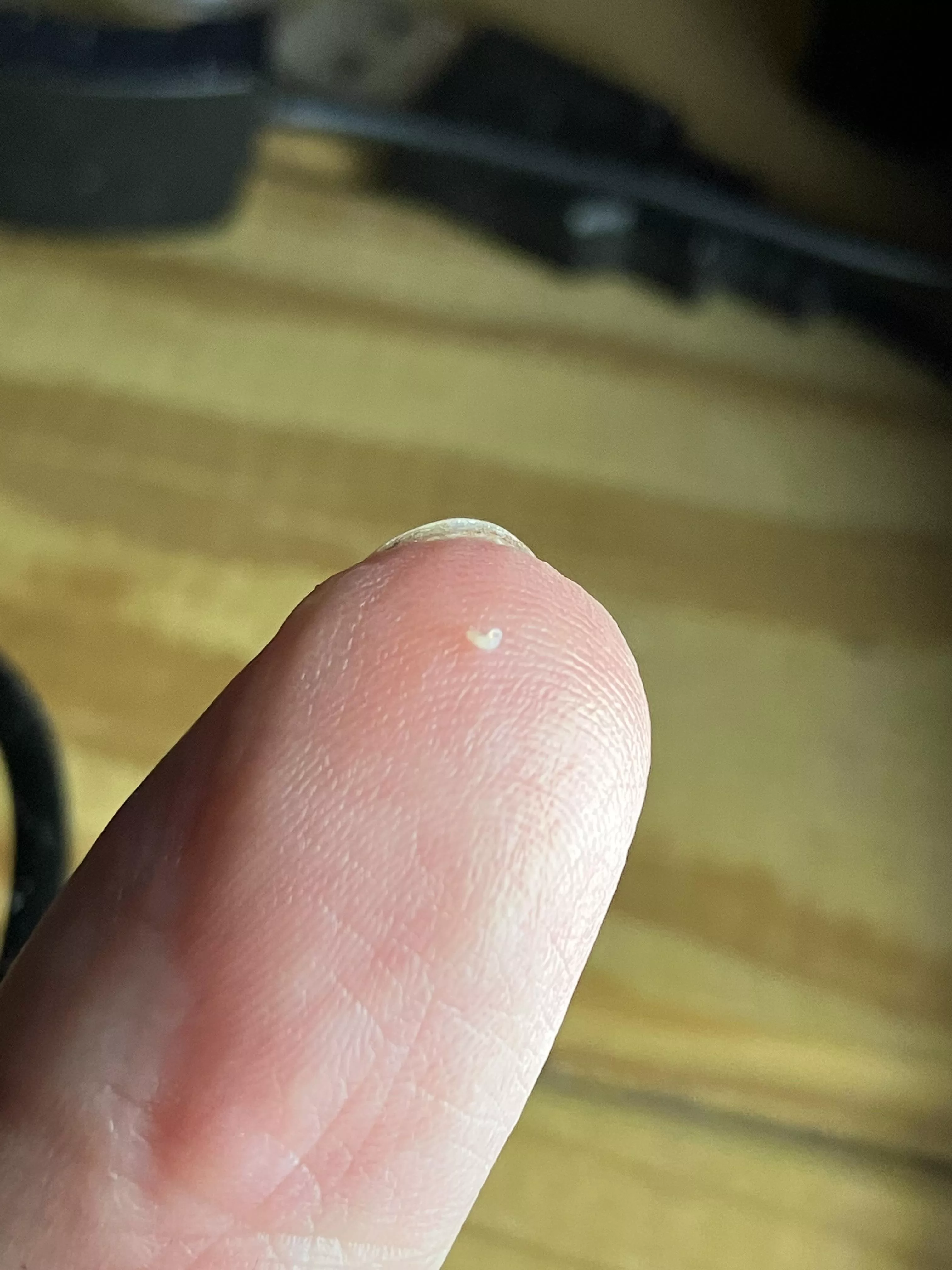 Finally got the sac out of a reoccurring little cyst. How can something so small cause such an issue posted by GemHatesStarWars