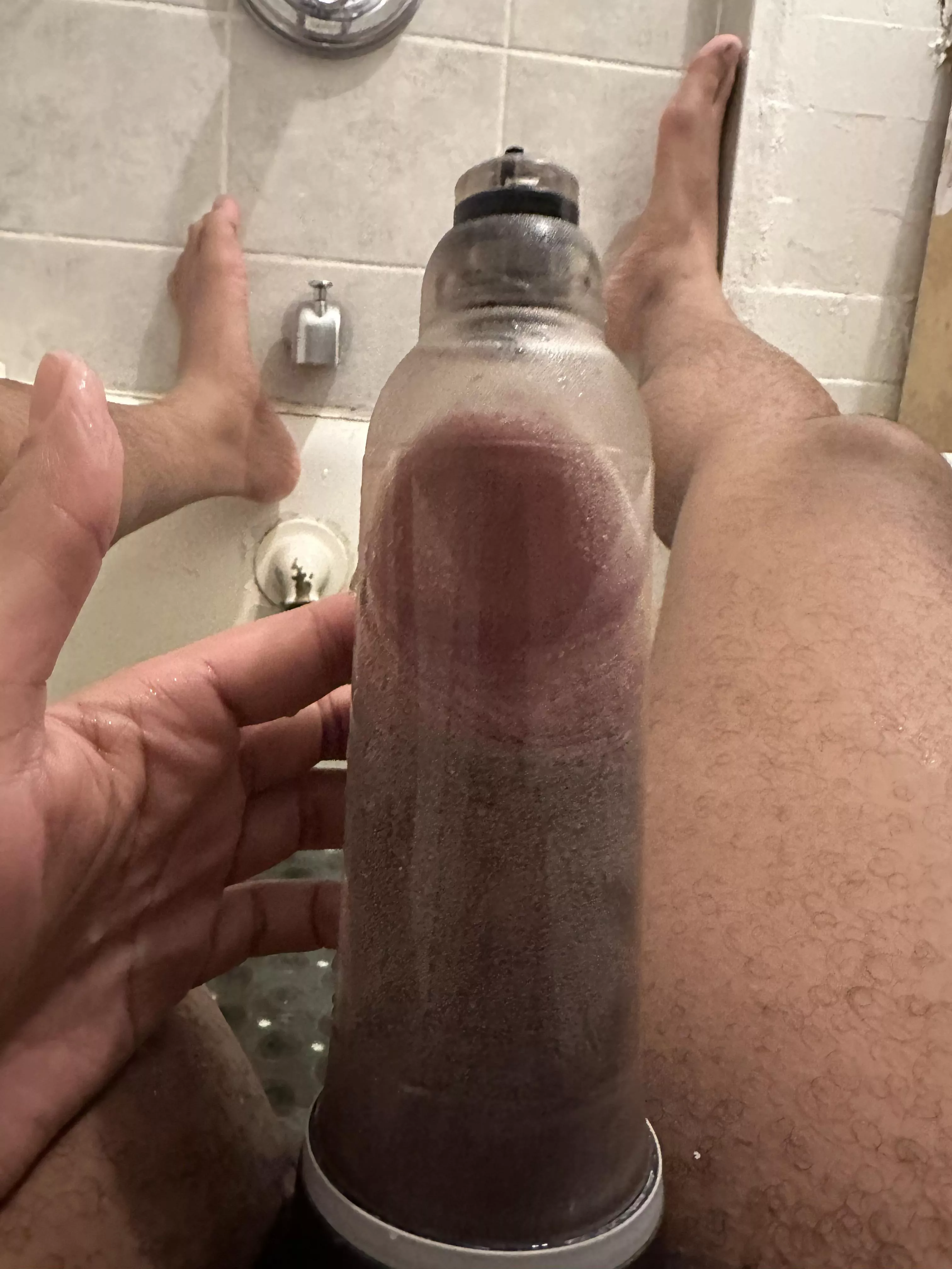 First of two 15 min sessions, minimal edema too! posted by Opening-Simple2208