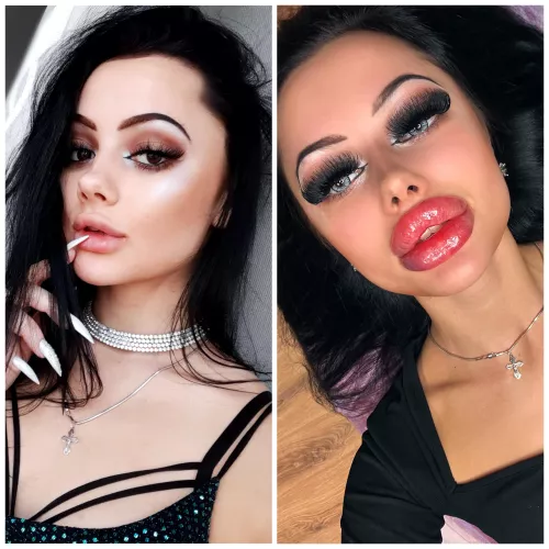 My lips transformation. Do you think they should be bigger? by Fine-Ad2329