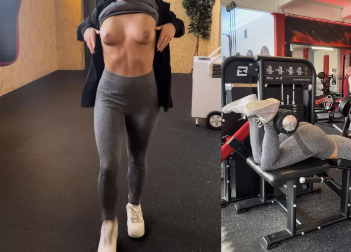 I asked my PT to take a progress pic of me. I don’t think he expected me to [f]lash him 😅 by Accomplished-Leg-877