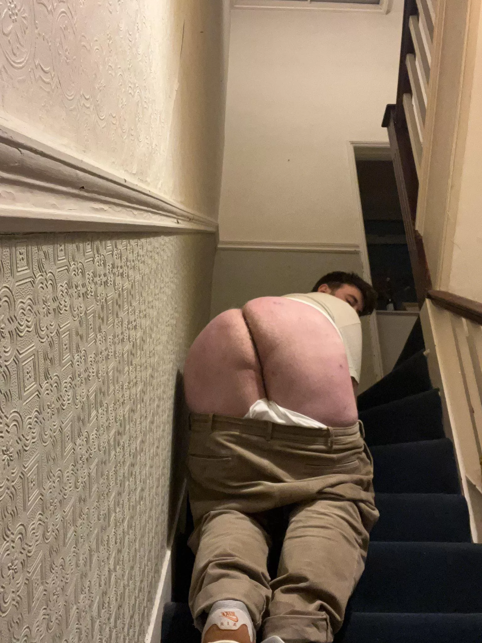 oops, fell over on the stairs😪 posted by Gaycubb