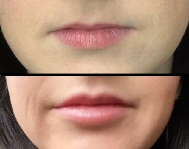 Wife's first lip upgrades. What do you think? by OneSection2628