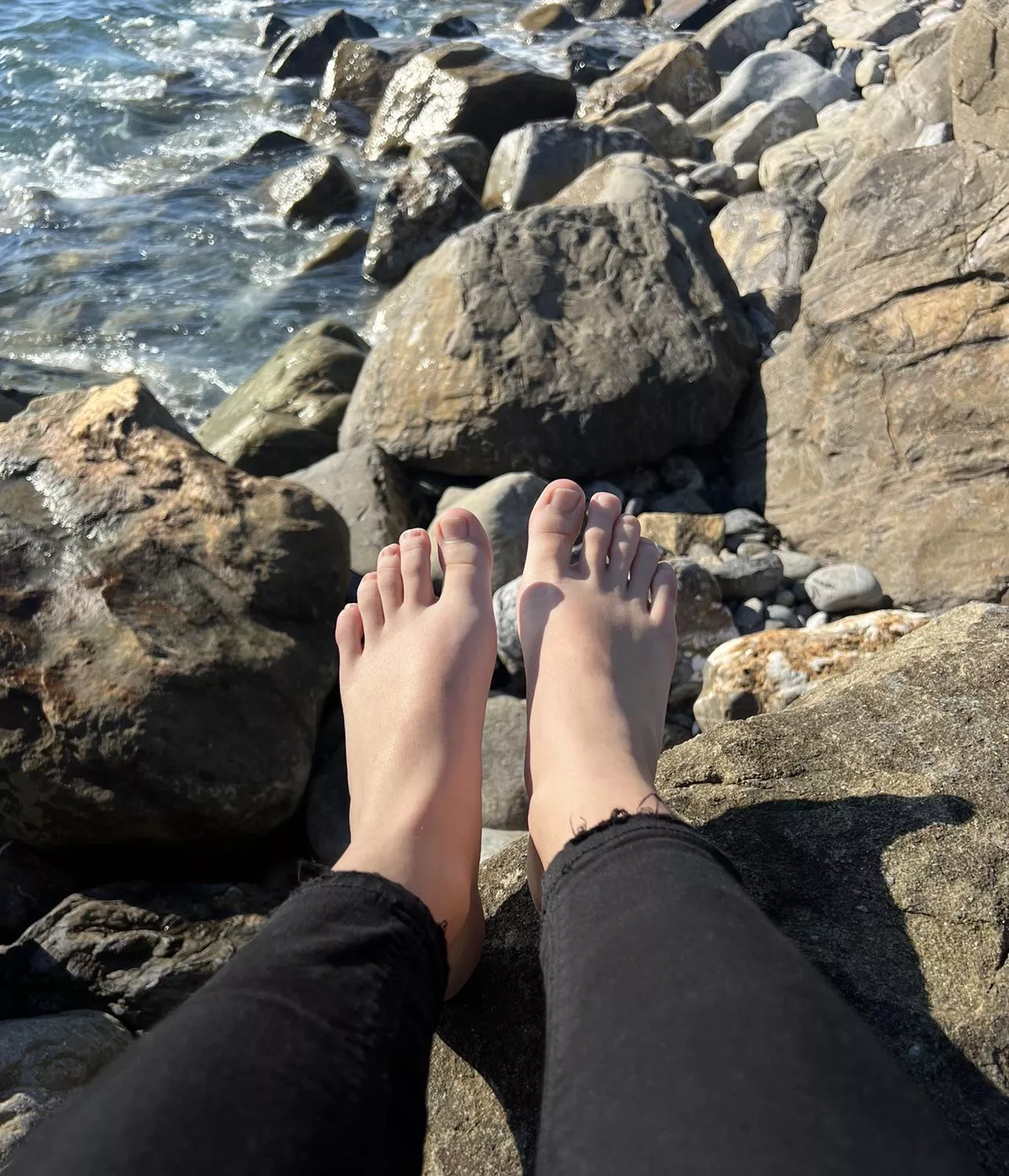 Are they ugly?🙁 posted by Pretty_Mya