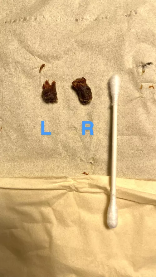 GF noticed some wax in my ear today. Turns out I’ve been wearing earplugs for years by bibliotaco