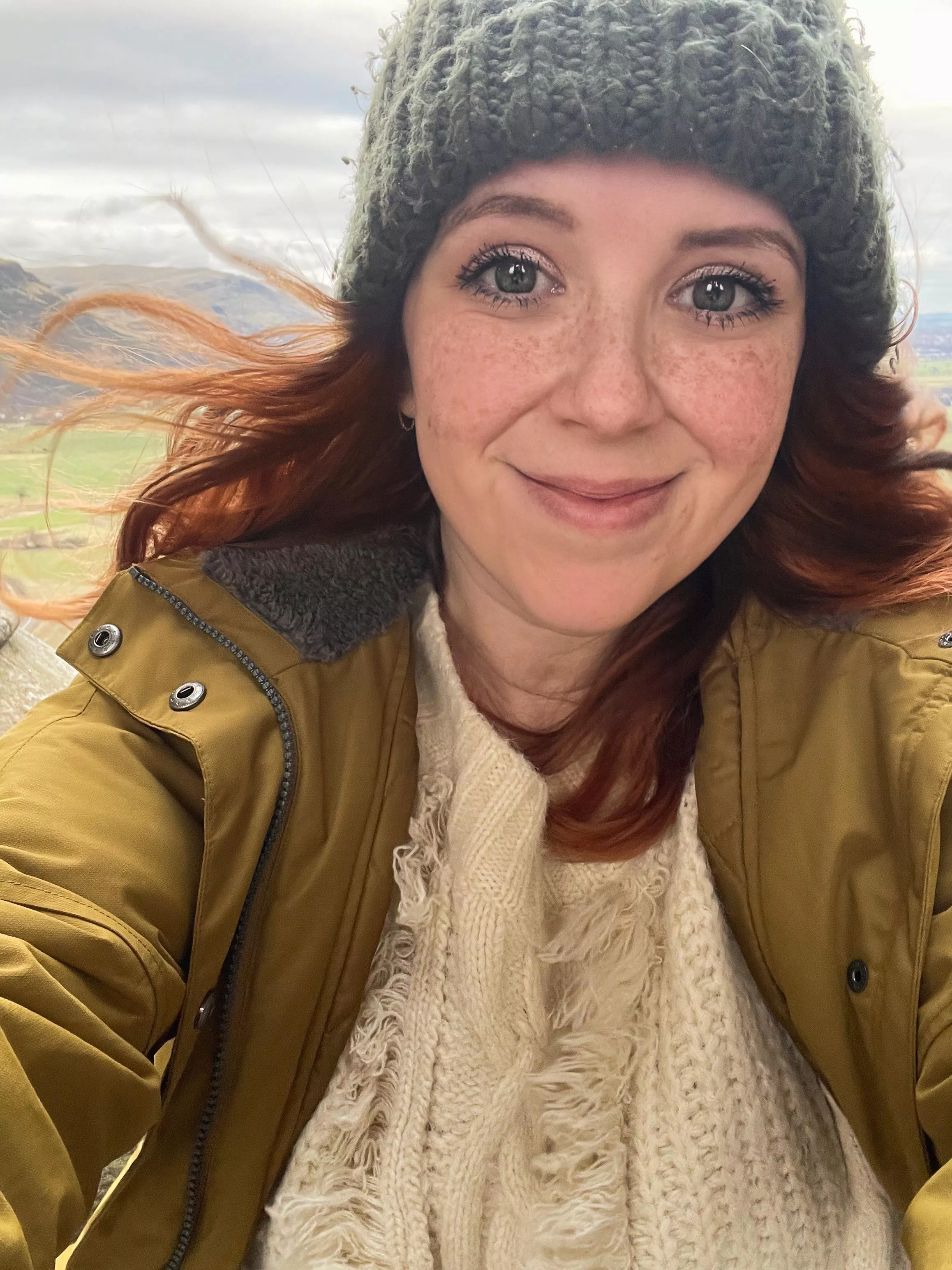 Thought my freckles looked cute here 💕 [F] posted by snildeep