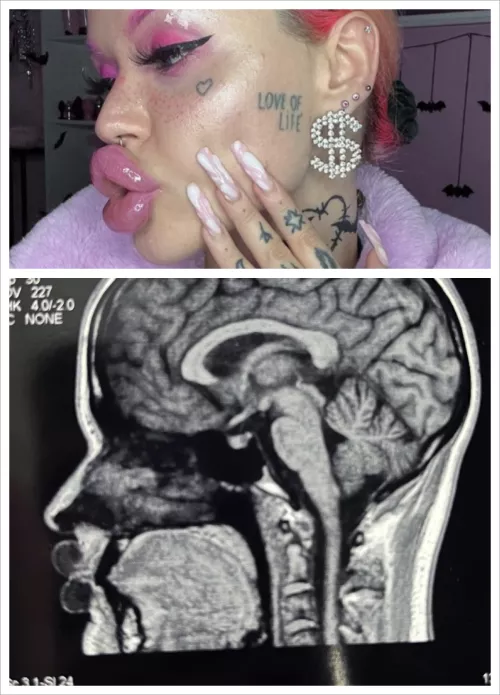 u/nasty_bimbo ducky lips X-ray by Large_Ant_9893