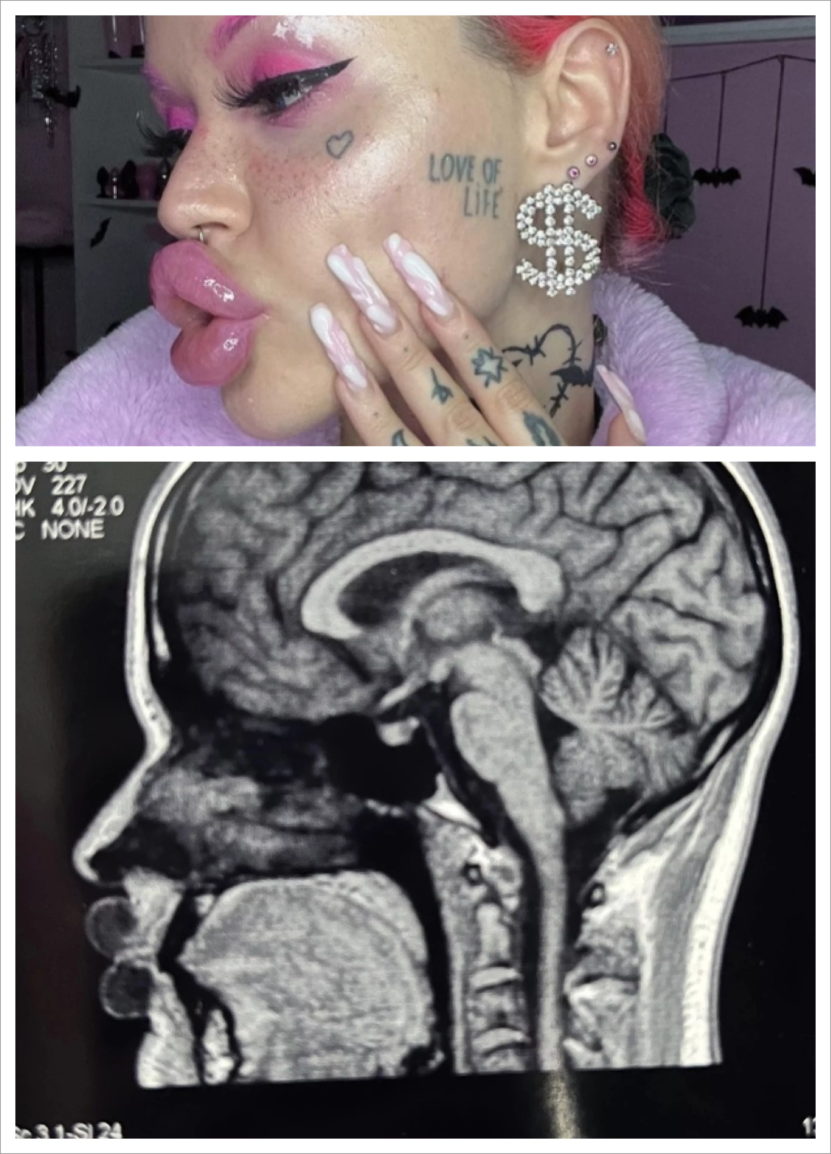 u/nasty_bimbo ducky lips X-ray posted by Large_Ant_9893