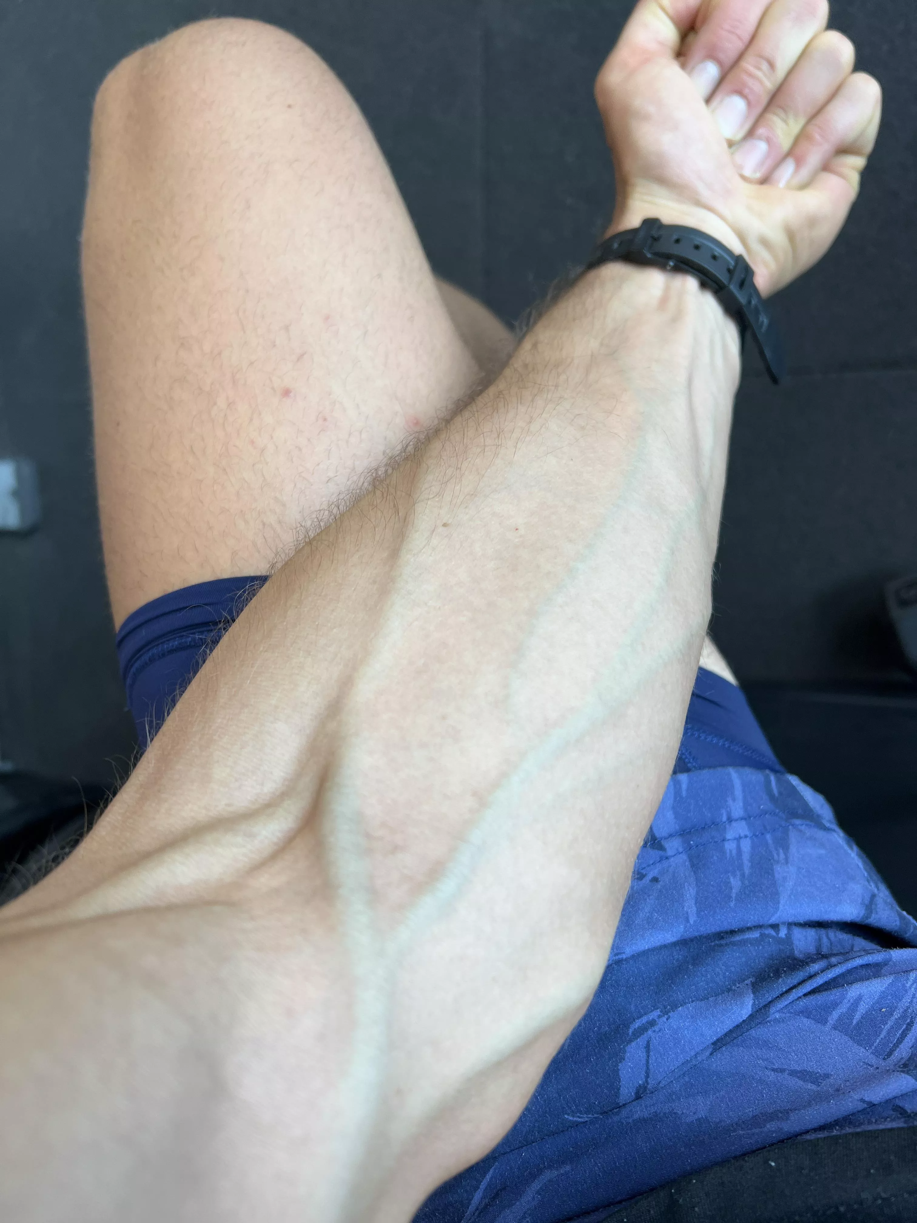 Any nurses in here? posted by hollywooodjack