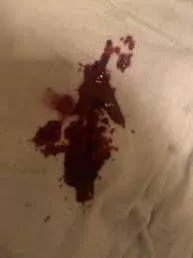 Storytime: Delicate Explosion posted by Walniw