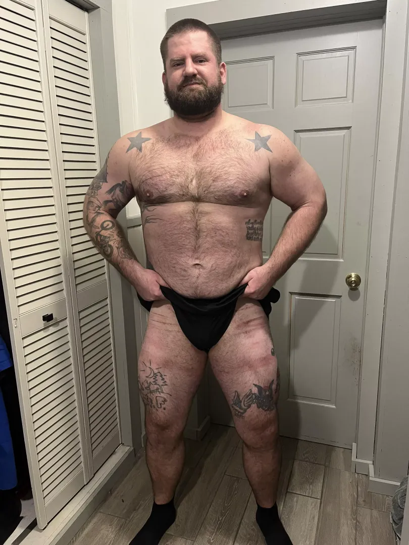 Bruises looking like tiger stripes posted by Deepercheeks