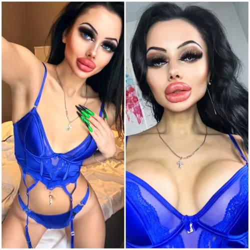 Showing my new boobs for the first time since surgery by Fine-Ad2329