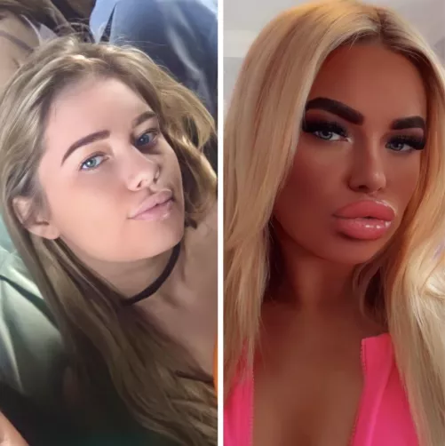 Before/After by Trapped2Life