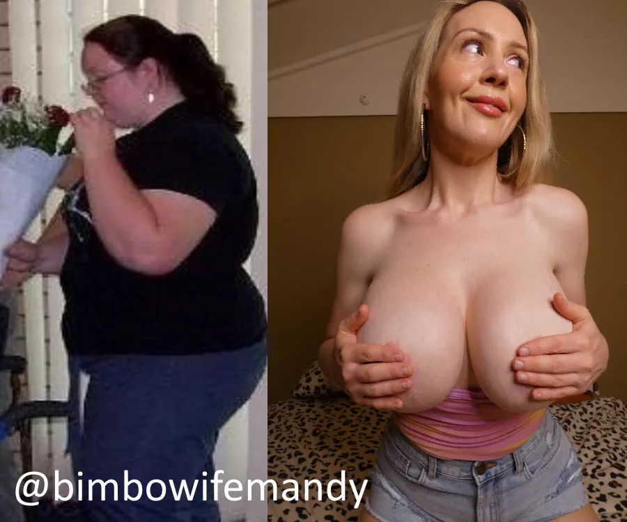 My (37F) Bimbo transformation - getting another upgrade in may to 2400cc posted by Initial-Brilliant682