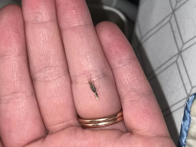 Not a pop, but this came out of my husbands belly button. by buttnuget69