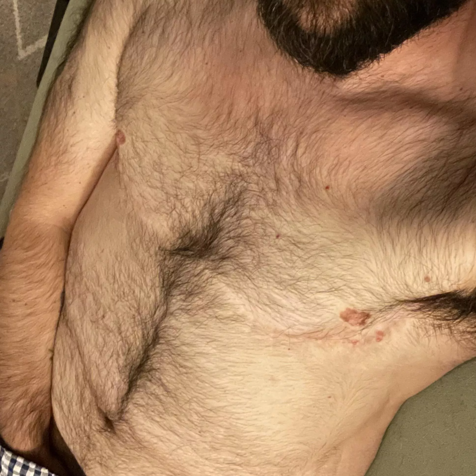 Thick & furry—any takers? posted by threeholemagic