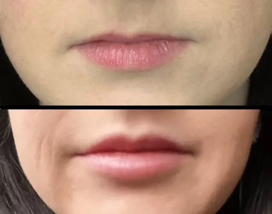 Wife got her first lip upgrades. How do they look? posted by OneSection2628