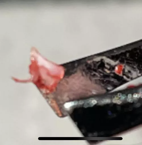 Haven’t been able to get into a podiatrist. There’s a huge wait list. Although not advised, I dug out a shard of my nail on my own. I got extremely hot, sweaty, and nauseous, but I got it out. At least some of it. And I feel so much relief. Sorry, no by makemeflyy