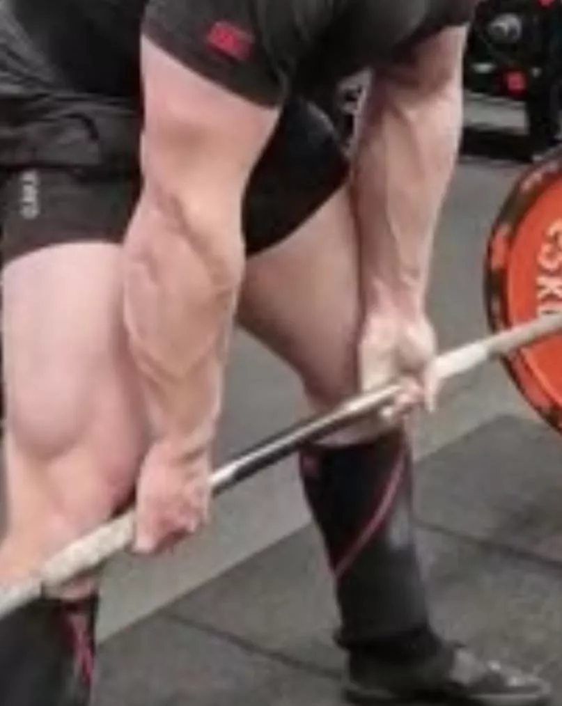 Mid-deadlift forearm explosion. posted by ginger_powerlifter