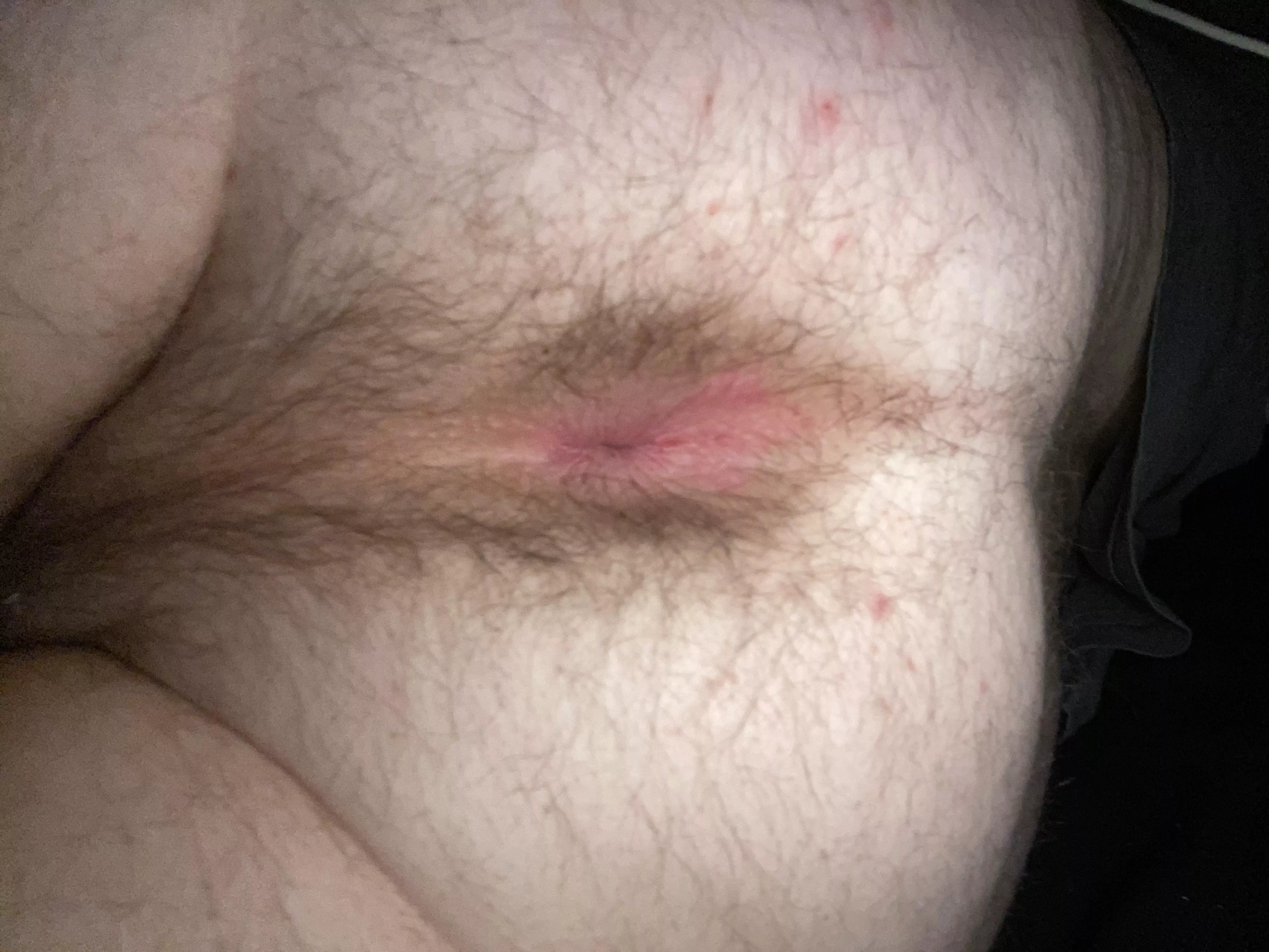 do you guys like pink holes? posted by slimeyglobe