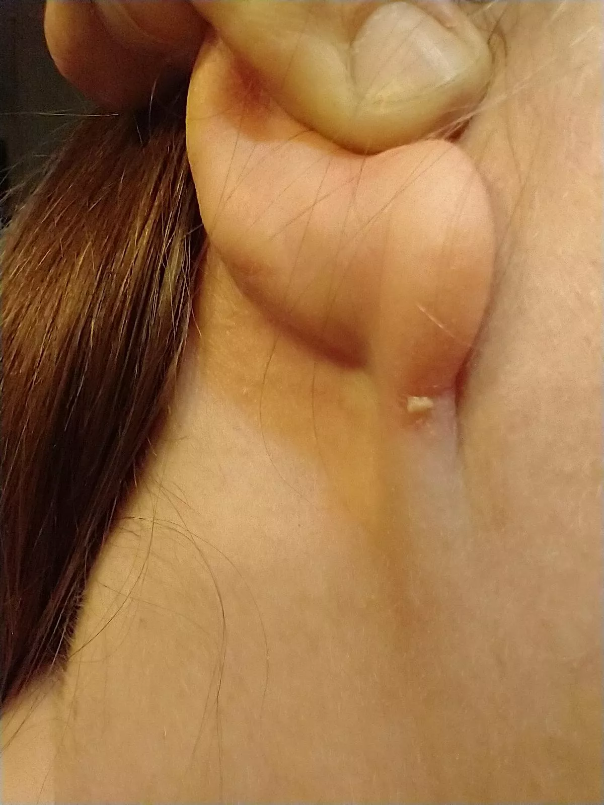 felt some soreness, gave a curious squeeze, was rewarded with a small gunk blob posted by lizardingloudly